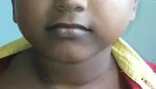 The normal position and range of motion are restored after surgical correction